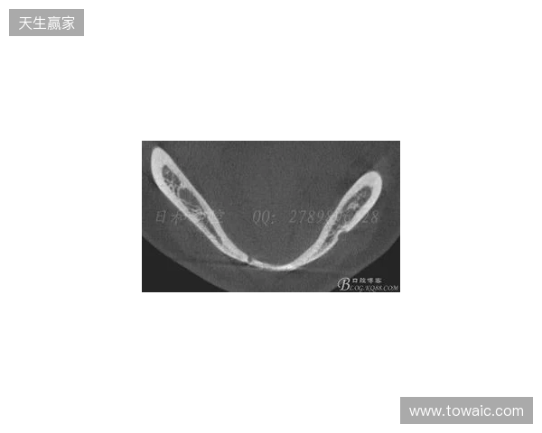 韦林顿确诊上唇部贯通伤;11、21牙半脱位;上颌前牙区牙槽骨骨折 韦林顿确诊上唇部贯通伤;11、21牙半脱位;上颌前牙区牙槽骨骨折